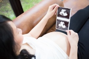 pregnant woman with ultrasound