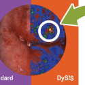 DySIS graphic