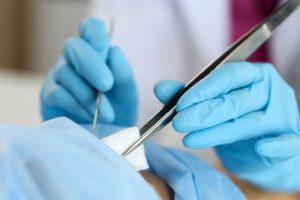 urethroscystoscopy surgery photo