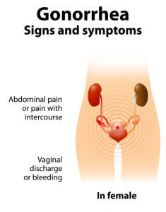 Gonorrhea Know The Warning Signs Symptoms And How To Protect Yourself