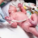 Should Parents Consider Cord Blood Banking?