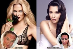 Vampire Facelift - Celebrity Photos