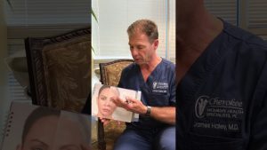 Cosmetic Fillers Explained