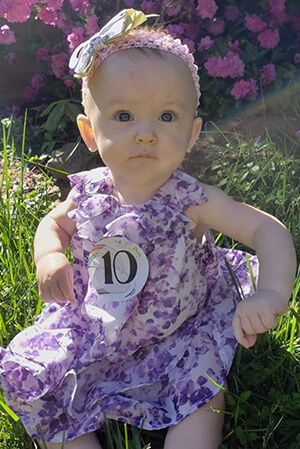 Preemie baby Aurelia After Pic