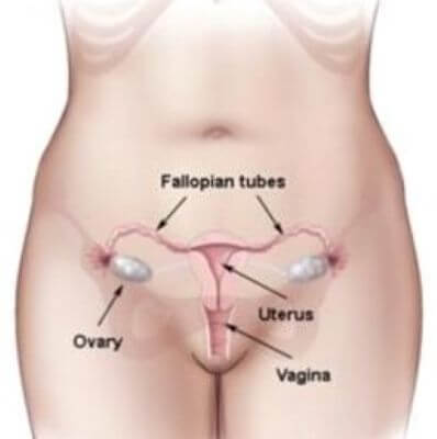 hysterectomy image