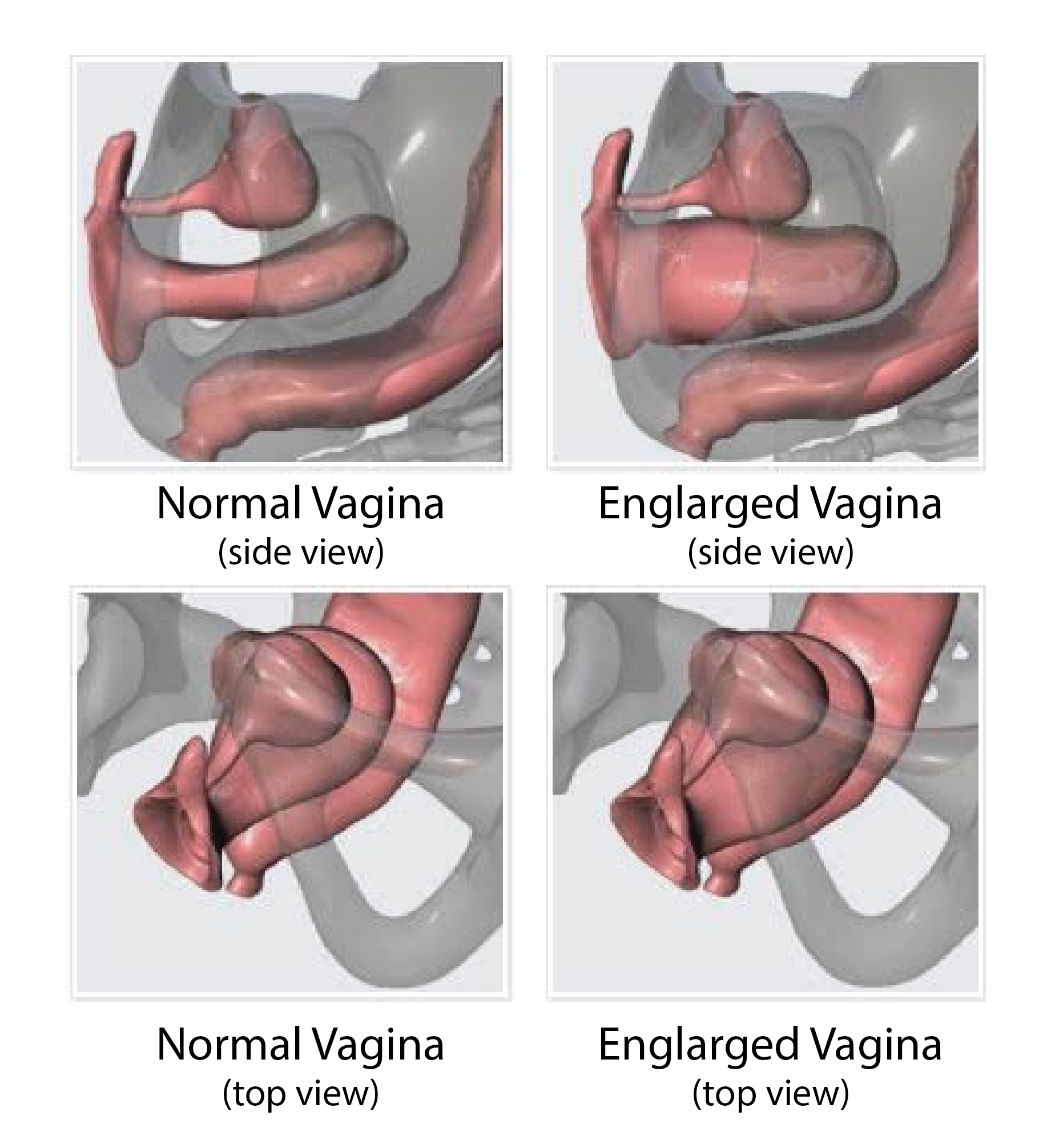 Gambar vagina normal