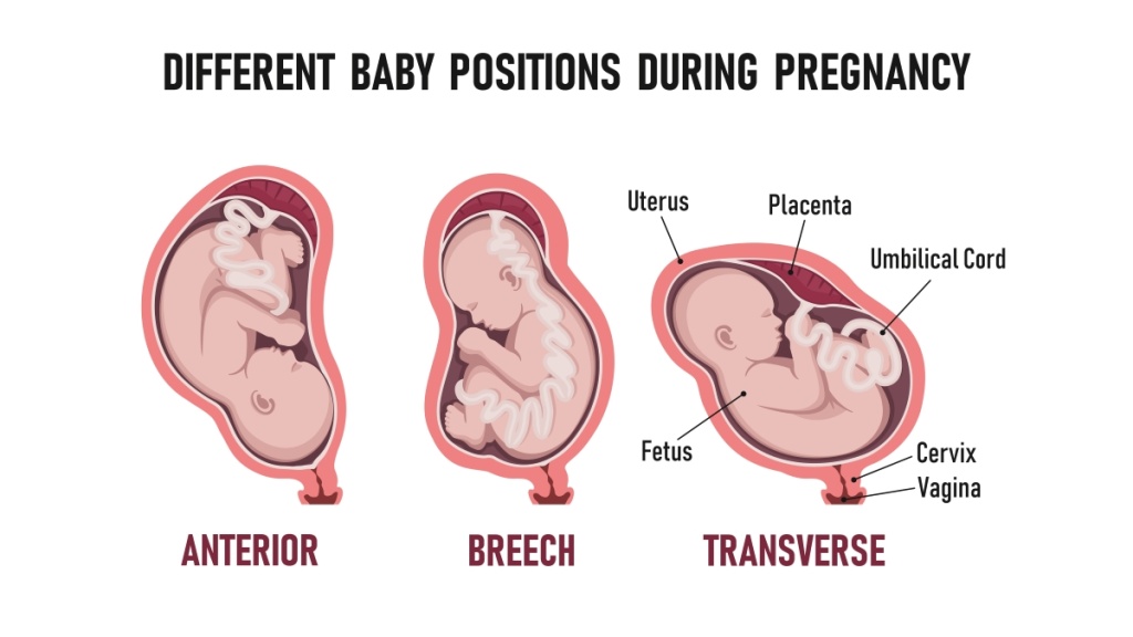 Different Baby Positions in the Womb - Cherokee Women's Health