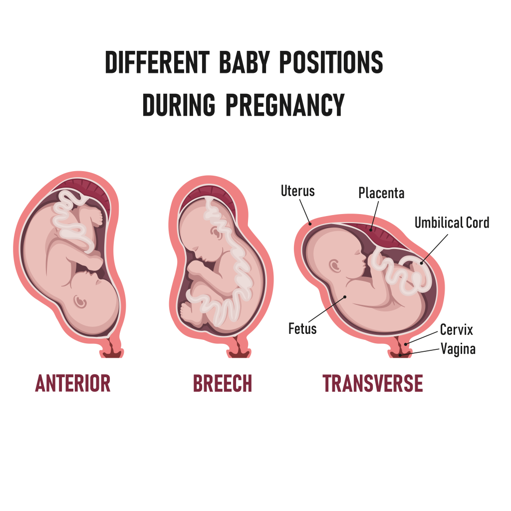 Different Baby Positions in the Womb Cherokee Women's Health