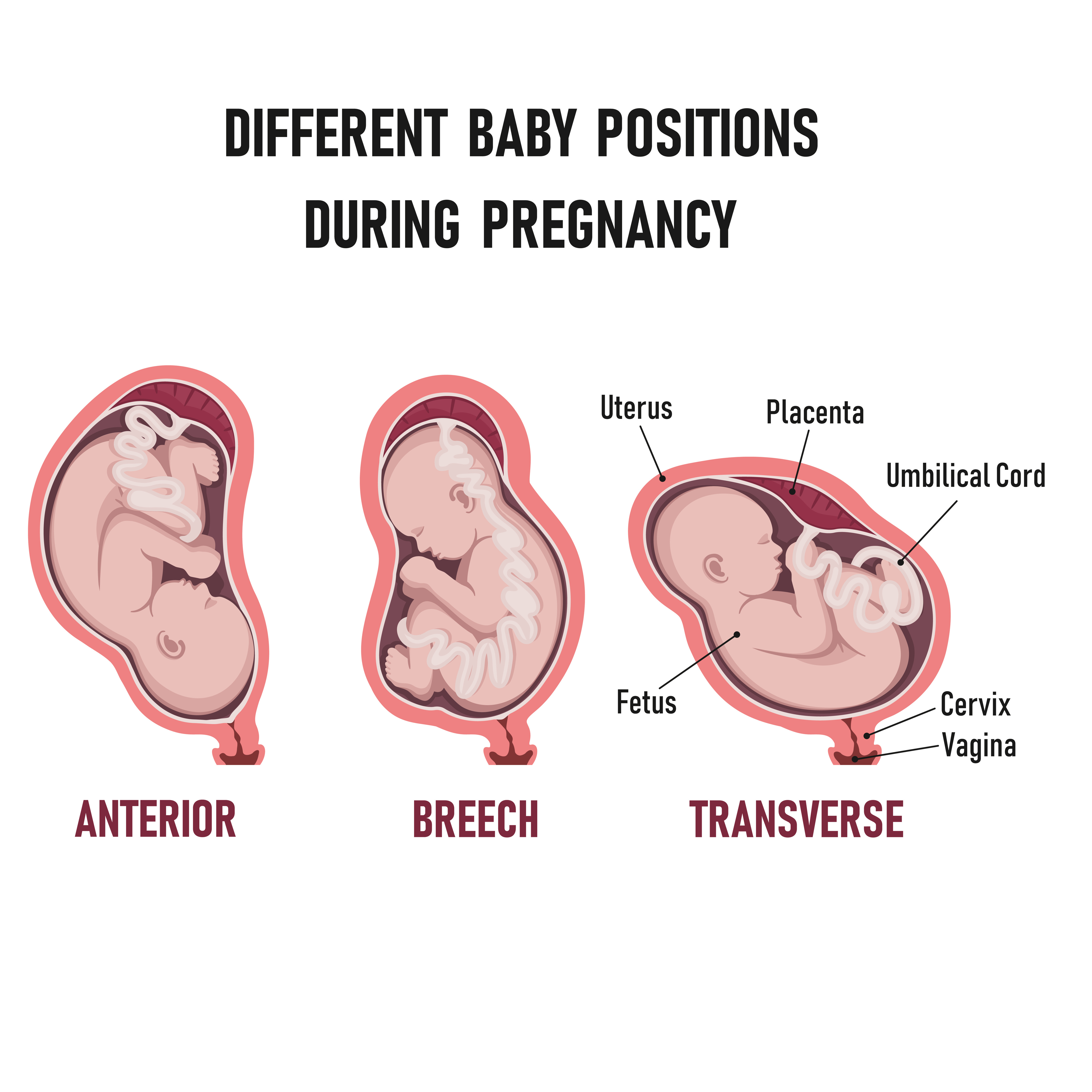 Explanation of Fetal Positions; What Poses Are Beneficial and What