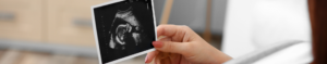 Ultrasound photo