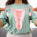 PCOS: Truths and Misconceptions